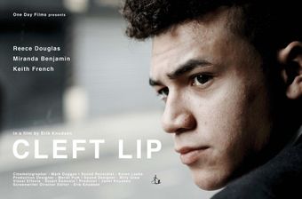 cleft lip 2018 poster